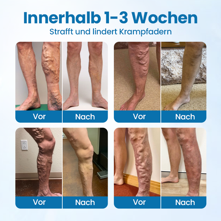 Timilk® VeinGuard Kräuterspray.