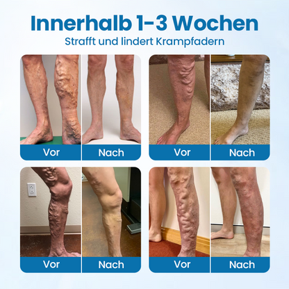 Timilk® VeinGuard Kräuterspray.