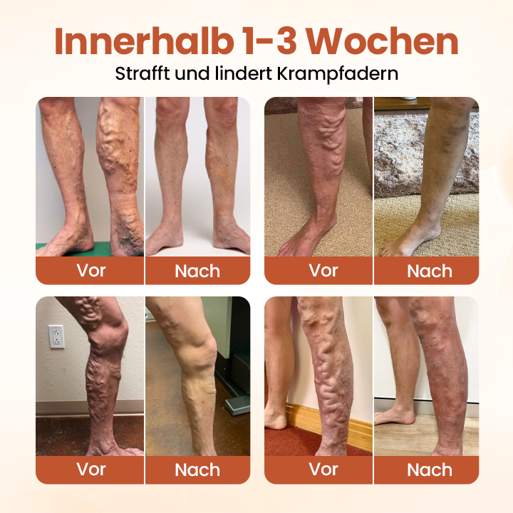 Timilk® VeinTarget Mikronadel-Pflaster
