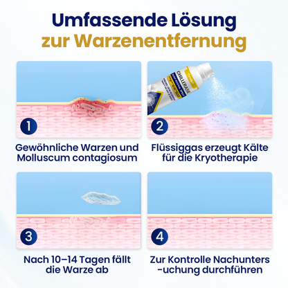 Timilk® ChillErase Erneuerungs-Spray gegen Hautunreinheiten.