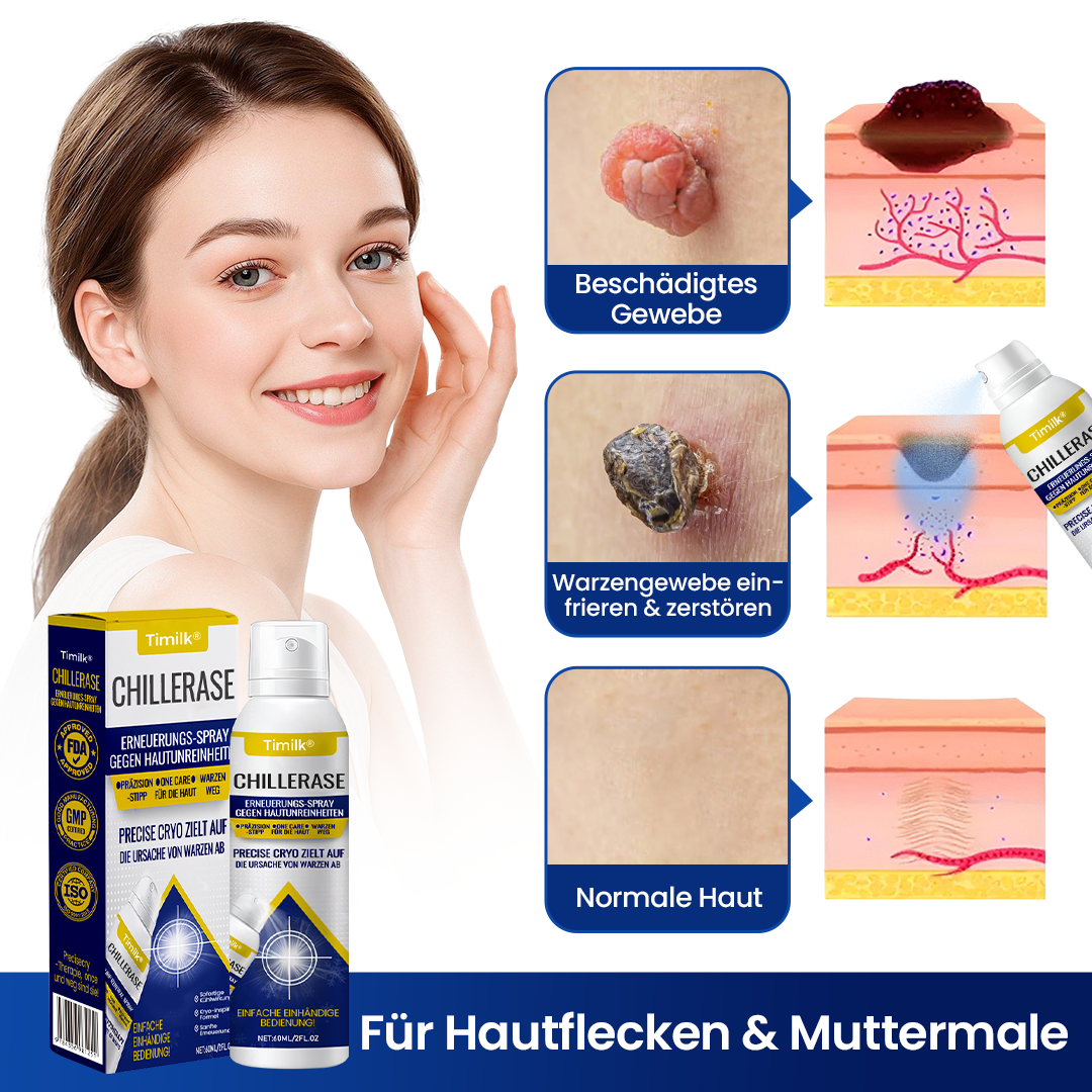 Timilk® ChillErase Erneuerungs-Spray gegen Hautunreinheiten.