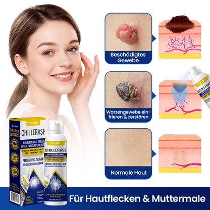 Timilk® ChillErase Erneuerungs-Spray gegen Hautunreinheiten.