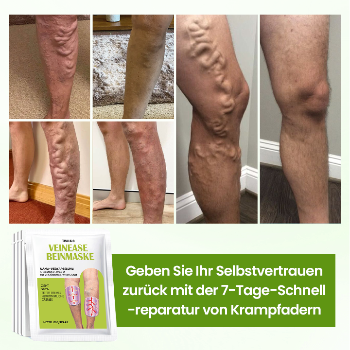 Timilk® VeinEase Beinmaske.