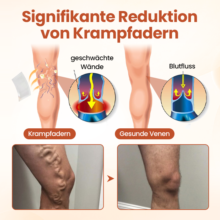 Timilk® VeinTarget Mikronadel-Pflaster