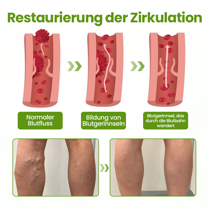Timilk® VeinEase Beinmaske.